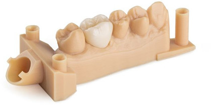 SLA Dental Model Resin